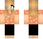 audreys skin