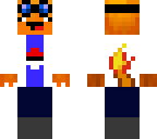 matthew's skin