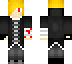 skinnormaledition