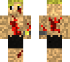 max the bloddy survivor