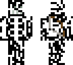 broken bones