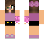toddler  with cast edit