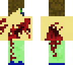 hurt boy