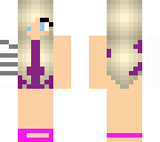girl hurt arm broken