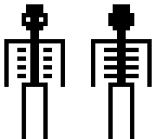 sceleton