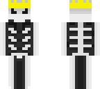 azure skelly king 1