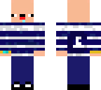 chri4master downsyndrom2