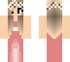 fixed dres