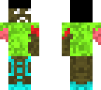 dude with no arm