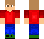 timmy's skin