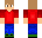 timmy's skin