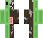 my **** skin
