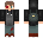 luke with weird eye blood 