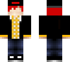 mi skin