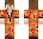 hurt prisoner