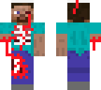 surgered steve