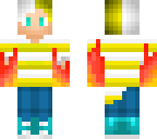 my skin