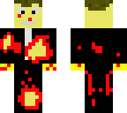 air crash survivor