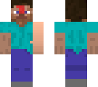 xd