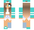 broken leg girl