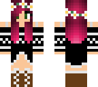 update for my skin -me rn