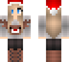 anna's skin