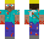 hurted miner