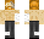 lewis liquid broken arm and leg