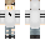 austin's skin