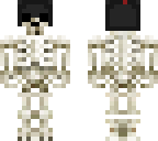 fixed