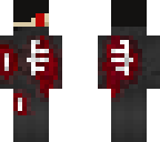 the skelmomba