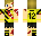 injured soccer player