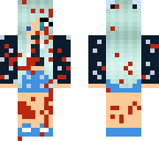injured