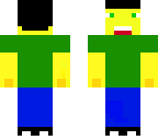 my skin