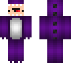 imcappas skin updated