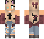 my skin