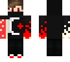 burnt arm