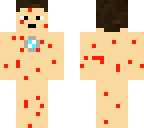 bleeding tony stark
