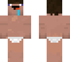 fix