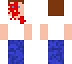 carl ross blood covered face