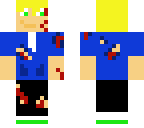 my skin 3