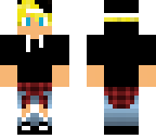 evan's skin