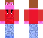 my skin
