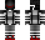 broken legs
