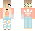 broken arm