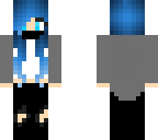 my casual skinm