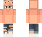 toms skin