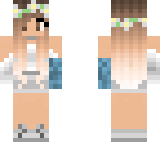 cute girl with broken arm