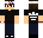 miger fixed
