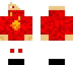 albino boy